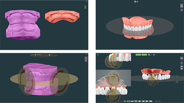 ＤＥＮＴＣＡ社のシステムを使ったデザイン