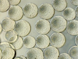 ＰＶＡ ハイドロゲルマイクロキャリア上の培養細胞の顕微鏡画像