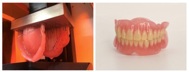 クルツァージャパンの歯科用3Dプリント事業